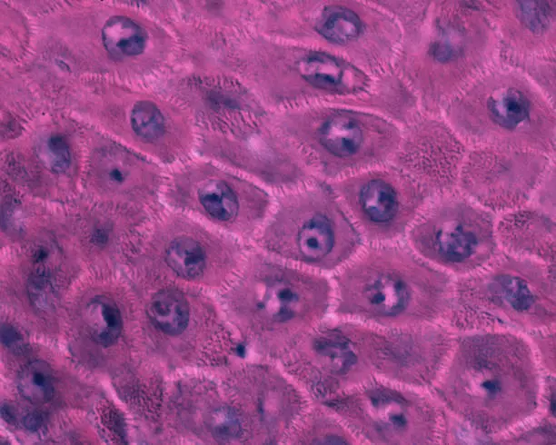 Photo of Human epidermis. Stratum spinosum