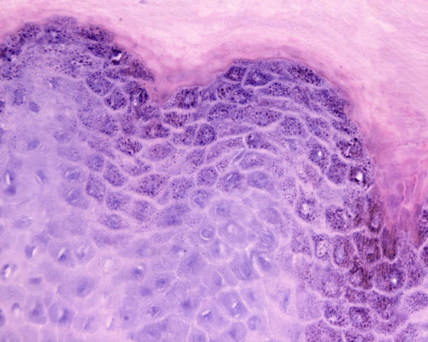 piel humana. verruga plantar - human tissue histology dermatology human skin fotografías e imágenes de stock