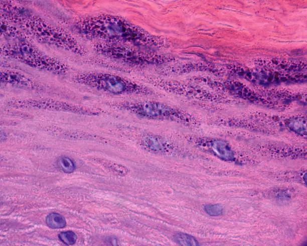 Photo of Human epidermis. Stratum granulosum