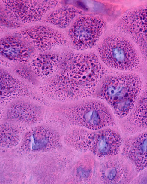 Photo of Human epidermis. Stratum granulosum