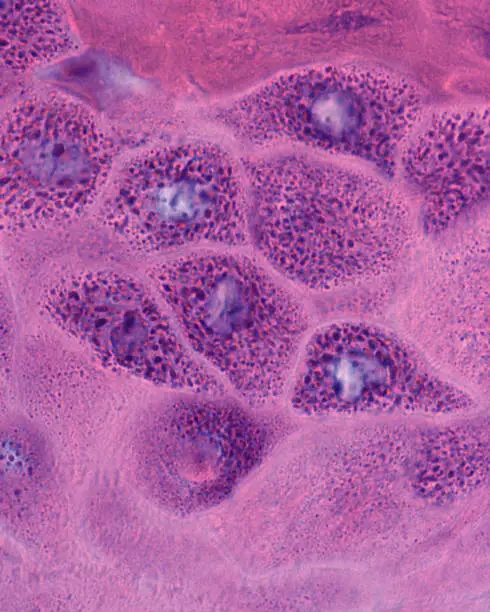 Photo of Human epidermis. Stratum granulosum