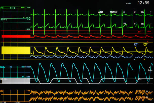 istock Vital signs monitor 1349467036