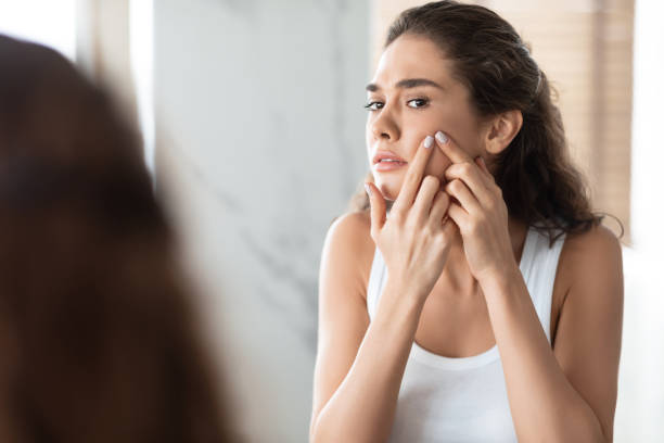 istock Unhappy Female Squeezing Pimples On Cheek Looking At Mirror Indoor 1349962151