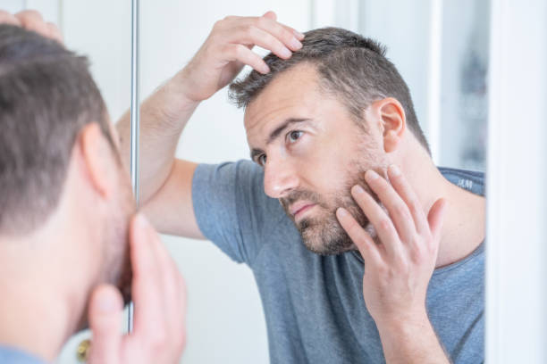 istock One worried man examining hair loss problem in the mirror 1349969305