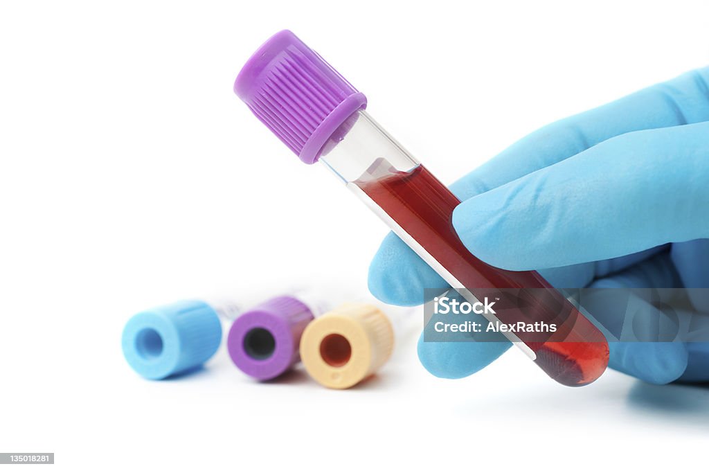 Amostras de sangue - Royalty-free Amostra Médica Foto de stock