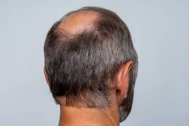 217 Hair Raise Neck Stock Photos, Pictures & Royalty-Free Images - iStock 217 Hair Raise Neck Stock Photos, Pictures & Royalty-Free Images - iStock