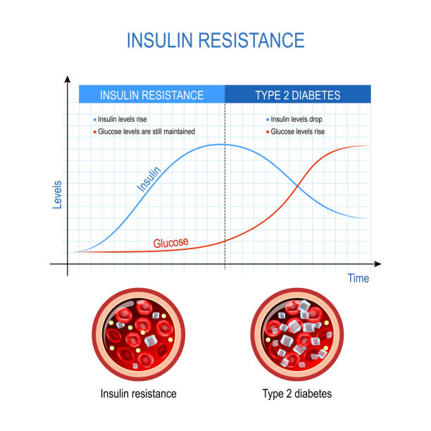 Insulin resistance and Type 2 diabetes Insulin resistance and Type 2 diabetes. comparison and difference. high blood sugar. Chart with insulin and glucose levels. Cross section of blood vessel. Vector diagram glycogen stock illustrations