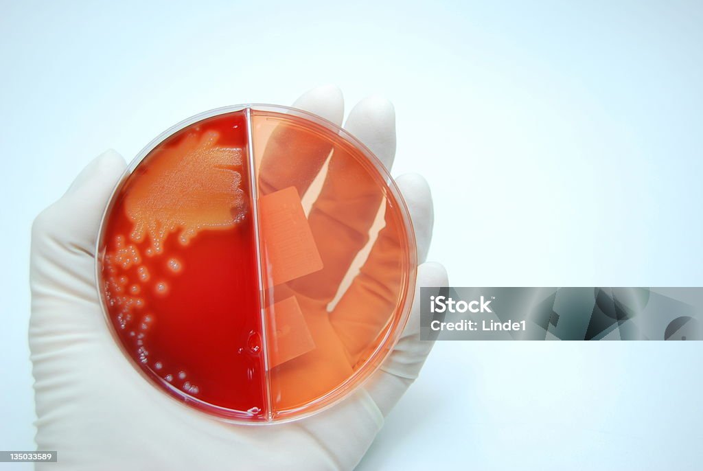 Microbiología, cultivo bacteriano - Foto de stock de Analizar libre de derechos