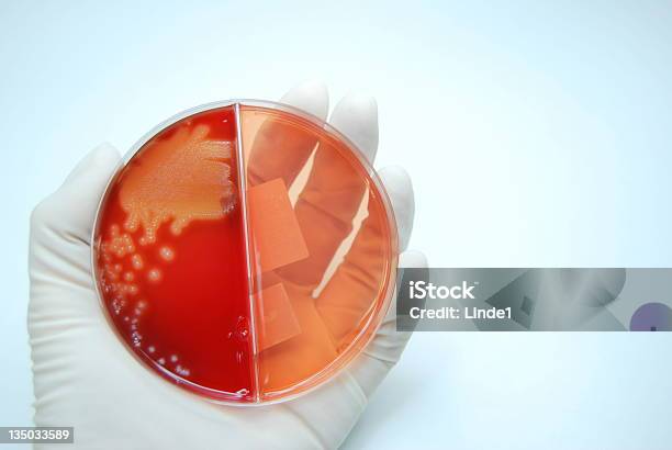 Microbiologia Batterica Cultura - Fotografie stock e altre immagini di Analizzare - Analizzare, Antibiotico, Antigienico