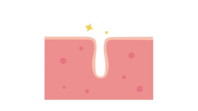 Cleaning clogged pores process 2D animation