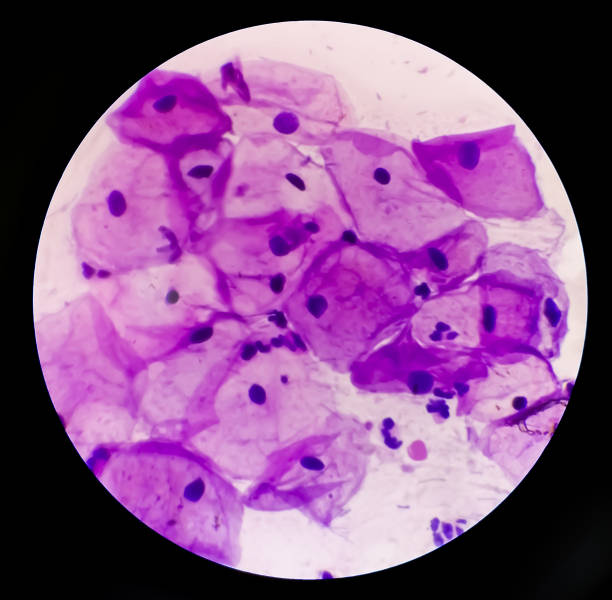 istock View in microscopic of human cervix cells. Squamous epithelial cells. Pap smear. pap's. cervical cancer diagnosis 1350412023