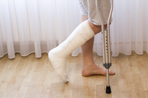 Close-up of man leg in plaster cast using crutches while walking. Broken leg.