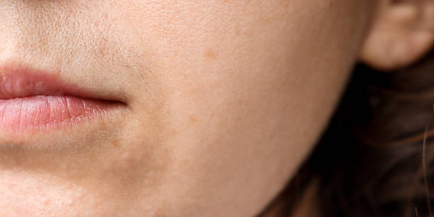 istock Close-up of a woman's face with a black mustache above the upper lip. Problematic skin, improper care and hirsutism. 1350463677