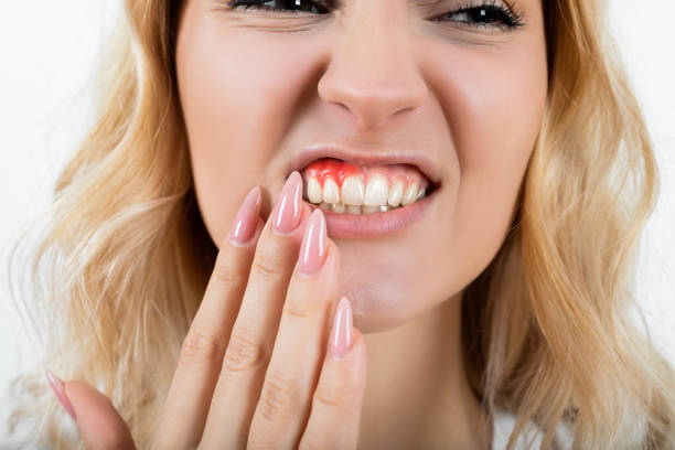 jeune femme souffrant de maux de dents - gums photos et images de collection