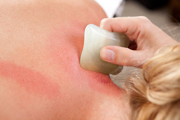 Redness During Gua Sha Detail showing redness on skin during a gua sha acupuncture treatment shiatsu photos stock pictures, royalty-free photos & images