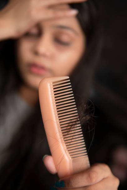 istock Young woman suffering from hair fall problems. 1350631233
