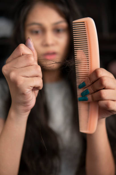 Young woman suffering from hair fall problems. Young Indian woman getting worried about her hair fall problems. arthropod stock pictures, royalty-free photos & images
