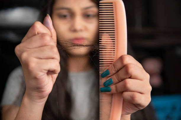 istock Young woman suffering from hair fall problems. 1350631333