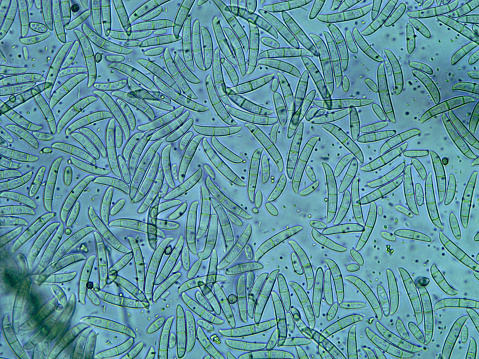 Fusarium oxysporum is a malignant phytoparasitic fungus. It mainly lives in the soil and causes root rot of crops. In wet years it is able to grow on grains and ears of wheat and barley.