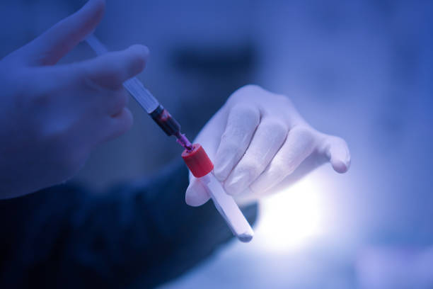 istock medicine hand glove draw blood sample inside for test 1350762020