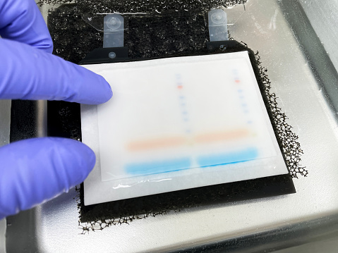 Wet transfer system of western blotting.Wet transfer system of western blotting, immunoblot. Transfering protein molecules from gel to PVDF membrane by electrophoresis.
Gel and membrane are in the cassettes