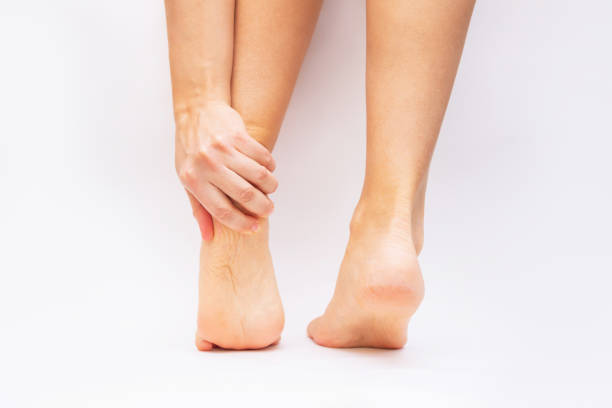 istock A woman holds a sore heel with her hand 1350849910
