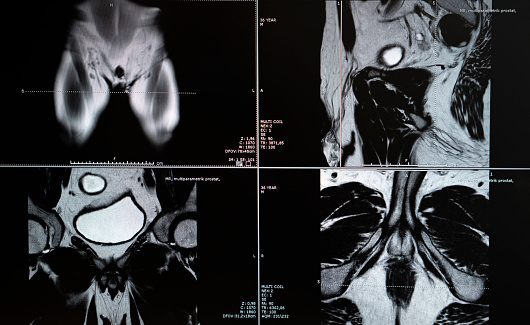 Close up of an elderly person with back pain in the lower spine isolated in white.