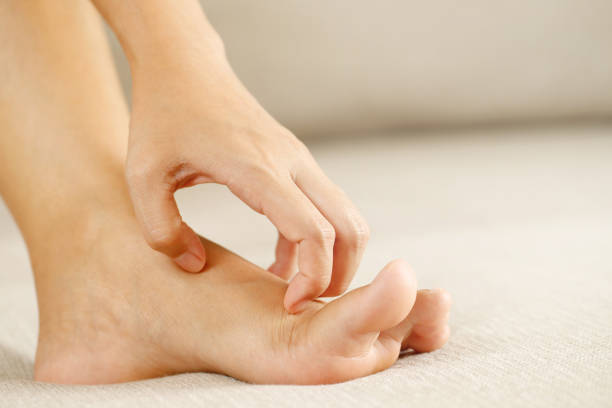 istock Fungal foot itching caused by biting feet 1351057543