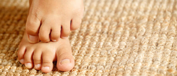 istock Fungal foot itching caused by biting feet 1351057862