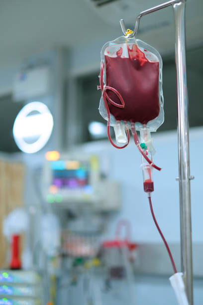 blood transfusion blood transfusion for patient with anemia in the critical care unit red blood cell photos stock pictures, royalty-free photos & images