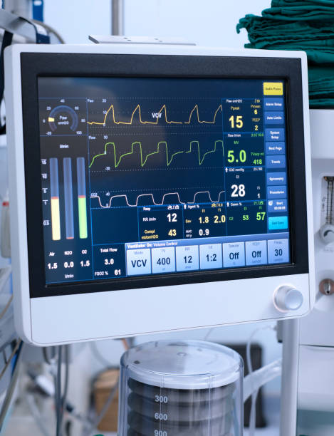 ventilator monitoring the screen of ventilator monitoring in operating room critical care photos stock pictures, royalty-free photos & images