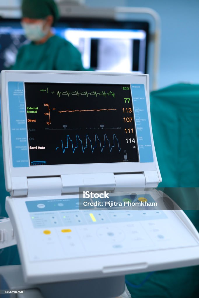 Intra-aortic balloon pump (IABP) machine - Royalty-free Bilgisayar Monitörü Stok görsel