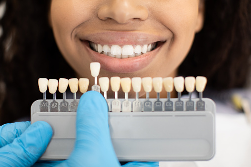 Unrecognizable Dentist In Sterile Gloves Holding Dental Teeth Shade Guide Chart, Choosing Right Emanel Color For Black Female Patient During Whitening Treatment In Modern Clinic, Closeup Shot