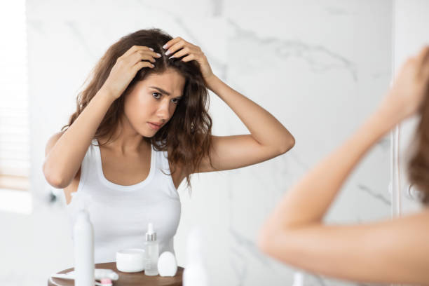 Frustrated Lady Searching Hair Flakes Suffering From Dandruff Problem Indoors Frustrated Young Lady Searching Hair Flakes Suffering From Dandruff Problem Standing Near Mirror In Bathroom Indoors. Haircare And Head Skin Health Concept. Selective Focus dandruff stock pictures, royalty-free photos & images