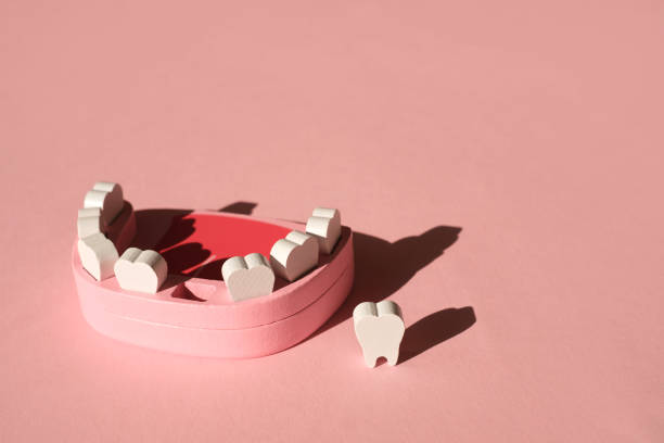 A model of a jaw with a lost front baby tooth on a pink background. A model of a fake jaw with a lost front baby tooth on a pink background. Dental implantation. Tooth loss due to illness. Dental and oral care. Artificial jaw for demonstration to patients gap toothed stock pictures, royalty-free photos & images