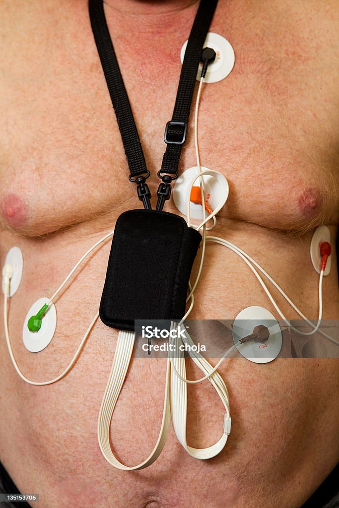 Holter monitor em pacientes do peito - Foto de stock de Adulto royalty-free