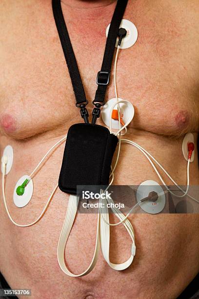 Foto de Holter Monitor Em Pacientes Do Peito e mais fotos de stock de Adulto - Adulto, Eletródio, Espontânea