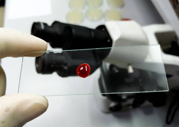 ученый держит стеклянную горку с каплей цельной крови, которая готова к дальнейшему микроскопическому исследованию. - blood cell blood red blood cell microscope стоковые фото и изображения
