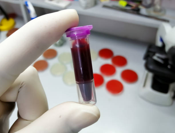 naukowiec trzyma eppendorf z próbką krwi, która jest gotowa do dalszego badania. zaplecze laboratoryjne. - blood sample blood tube pathologist zdjęcia i obrazy z banku zdjęć