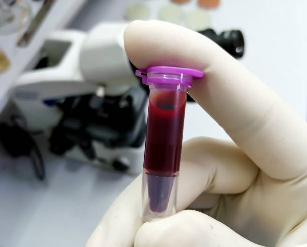 naukowiec trzyma eppendorf z próbką krwi, która jest gotowa do dalszego badania. zaplecze laboratoryjne. - blood sample blood tube pathologist zdjęcia i obrazy z banku zdjęć