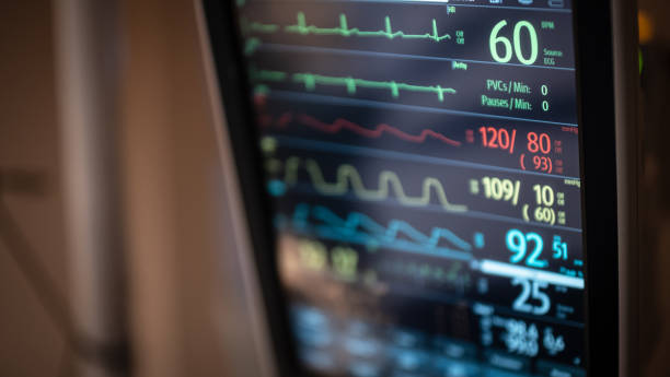 Patient Vital Signs A patient's vital signs are displayed on a bedside monitor. monitoring equipment stock pictures, royalty-free photos & images