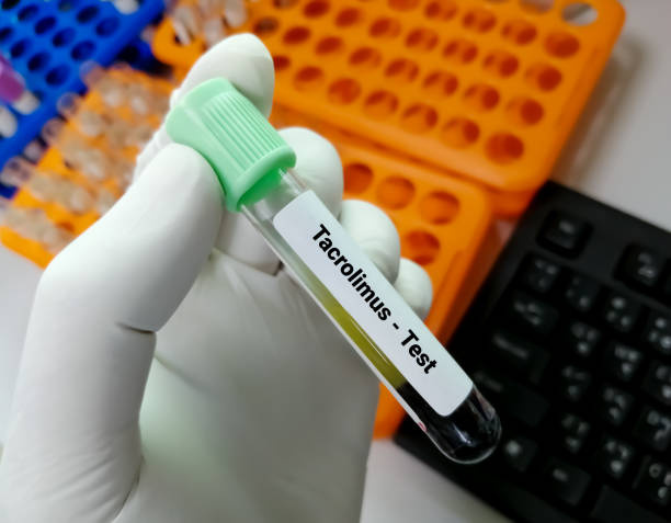 istock Technician hold blood sample with black background for Tacrolimus level test, immunosuppressive drug 1351797687