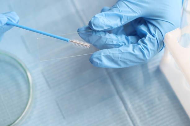 istock Taking vaginal smear from women on glass closeup 1351845326
