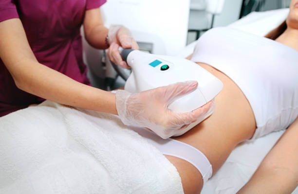 Attractive woman abdomen getting Cool sculpting procedure. Body slimming. Cryolipolyse and body contouring treatment, anti-cellulite and anti-fat therapy in beauty salon stock photo