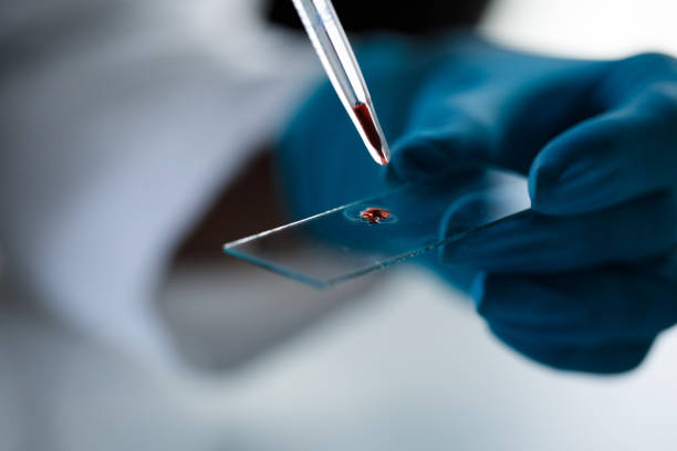 Lab tech putting a drop of blood, with a pipette, on a microscope slide Close up shot of unrecognizable scientist, in surgical gloves, putting a drop of blood or red liquid, with a pipette, on a microscope slide, for analysis. microscope slide stock pictures, royalty-free photos & images