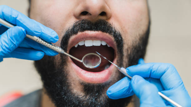 closeup cropped shot da boca aberta do paciente com dente ideal saudável e perfeito no check-up dentário. conceito de clareamento. estomatologista usando espelho - scrub brush - fotografias e filmes do acervo