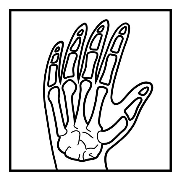 ilustrações de stock, clip art, desenhos animados e ícones de coloring book for kids, hand x-ray - 12026