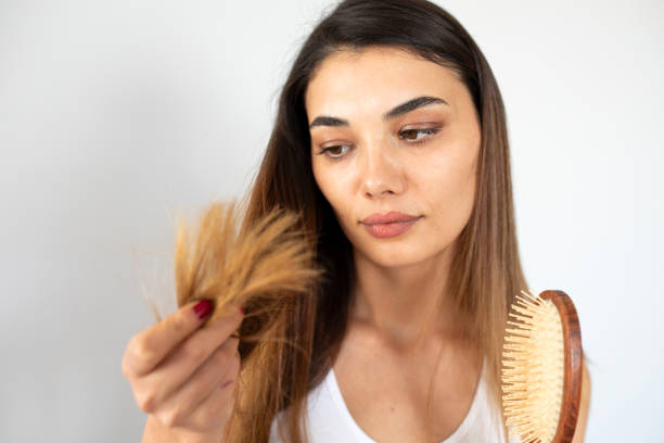 istock young woman have hair loss problem 1352137970