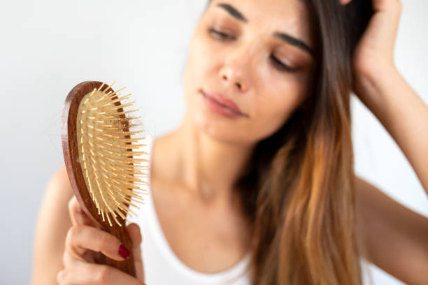 istock young woman have hair loss problem 1352138207