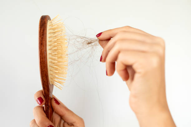 istock young woman have hair loss problem 1352138381